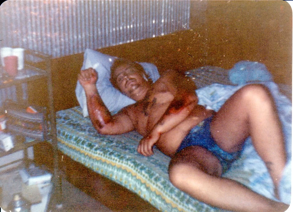 Patong Sea dragon Motorcykel olycka.webp